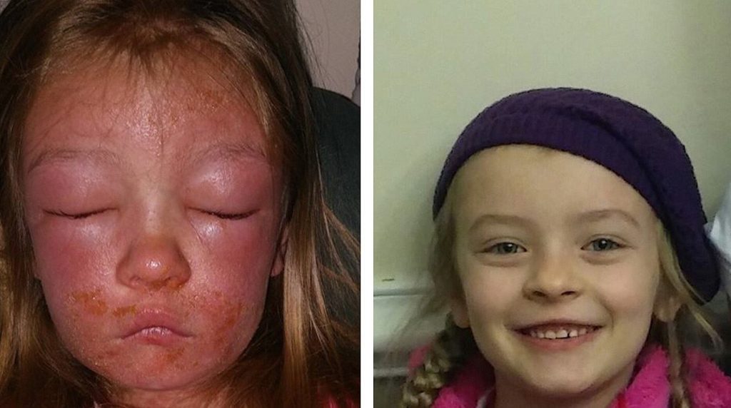EVERYONE Needs To Know What Happened To This Little Girl. Don’t Let It Happen To Your Own Children!!
