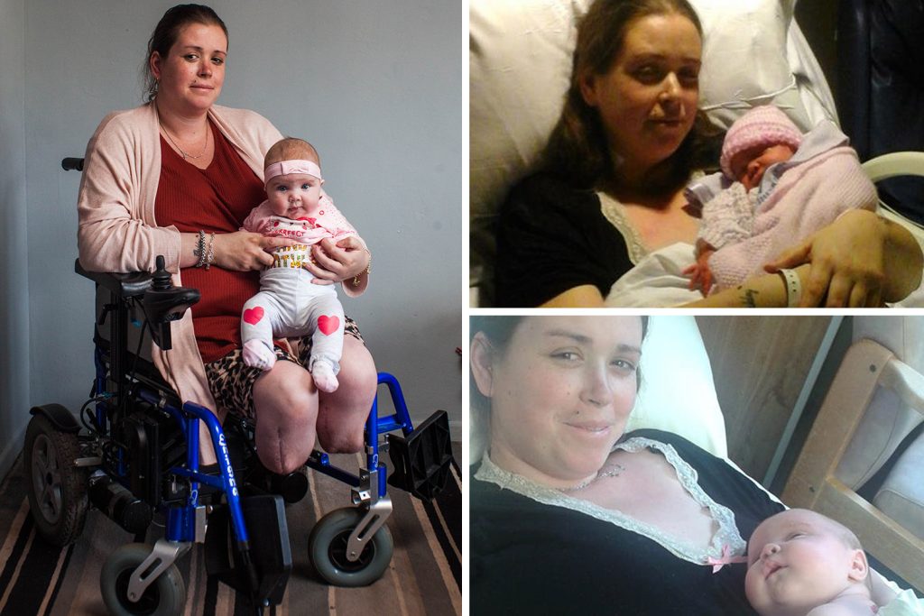 WOMAN WAKES FROM C-SECTION TO DISCOVER BOTH HER LEGS HAVE BEEN AMPUTATED